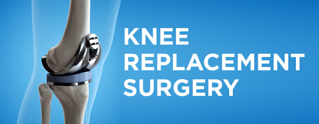 Best Hospital for Knee Replacement Surgery