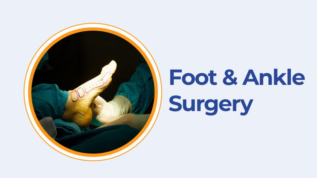 Best Foot & Ankle Surgery