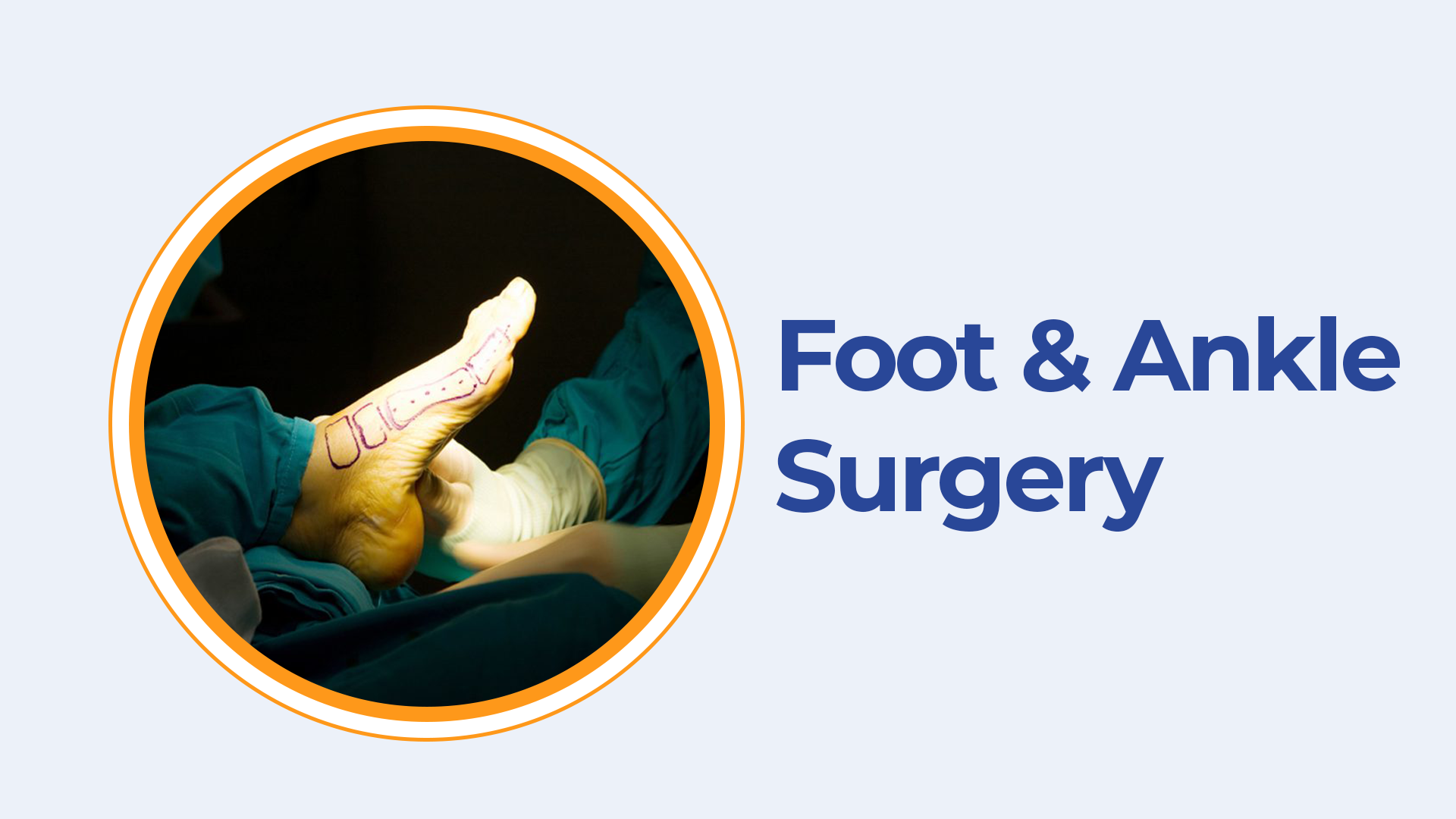 foot-and-ankle-surgery-best-foot-and-ankle-specialist-in-hyderabad