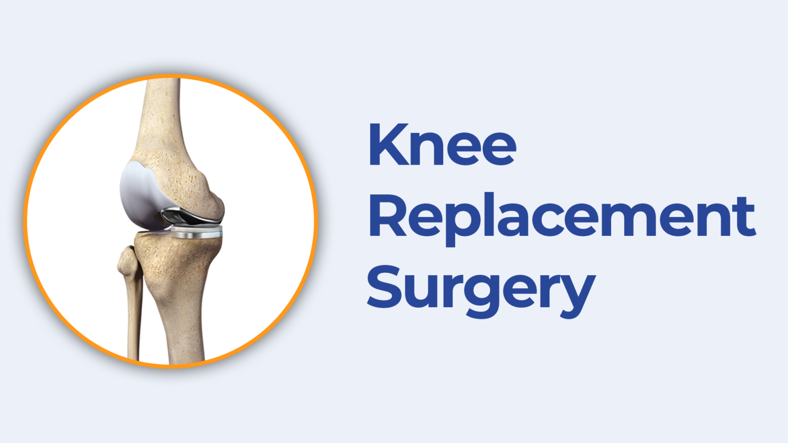 Best Knee Replacement Surgeon In Hyderabad Knee Replacement Doctor