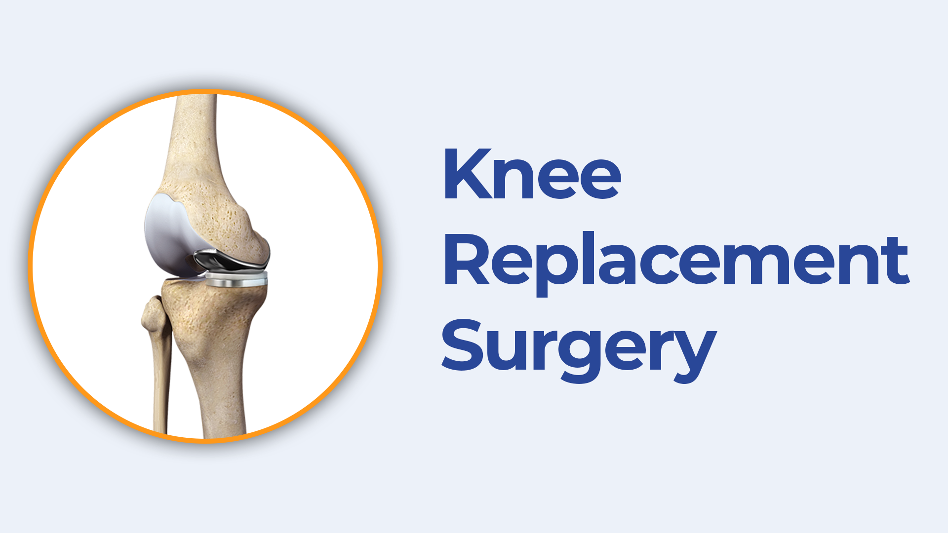 best-knee-replacement-surgeon-in-hyderabad-knee-replacement-doctor