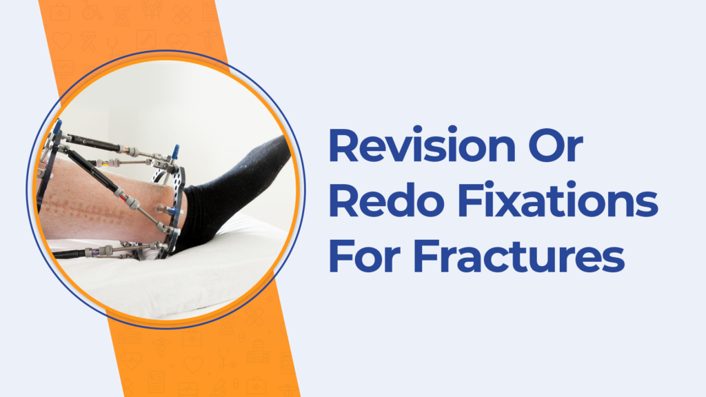 Best Revision Treatment for fractures