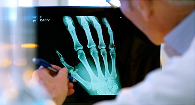 hand and wrist pain treatment