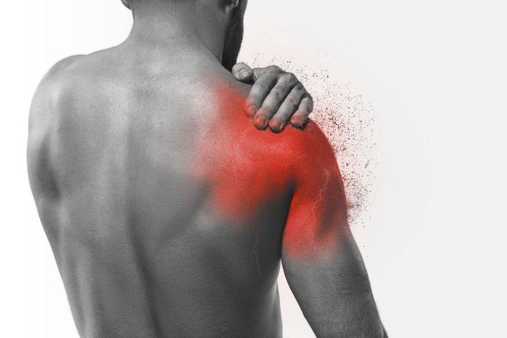 shoulder pain images