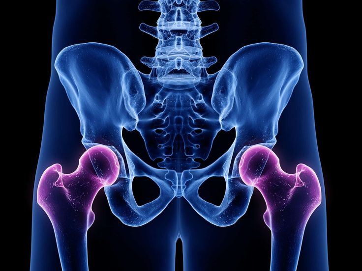 hip pain treatment in hyderabad