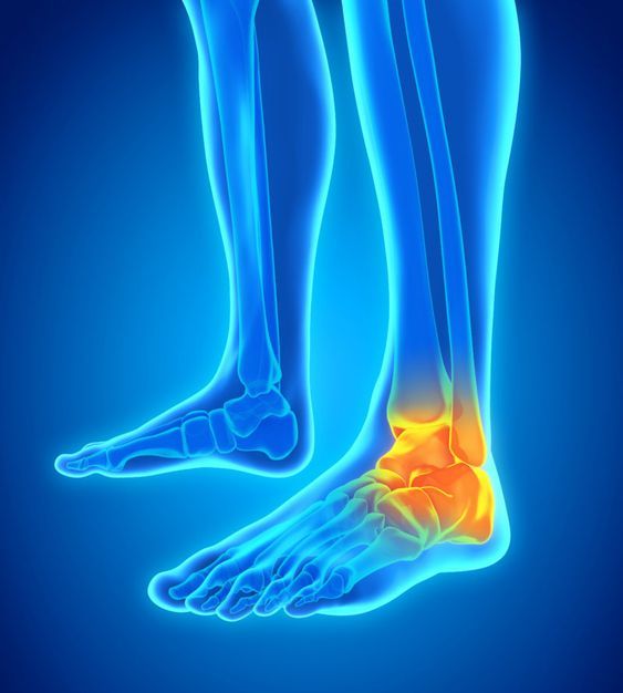 Foot and ankle pain.