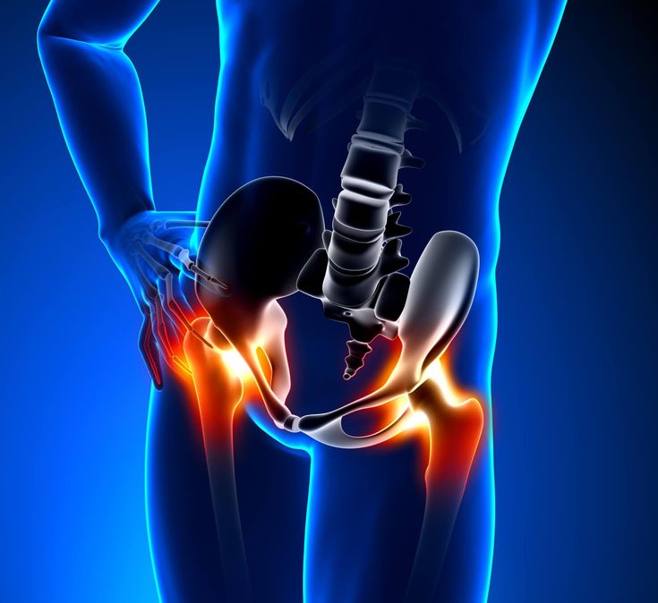 Hip Pain Treatment in Hyderabad