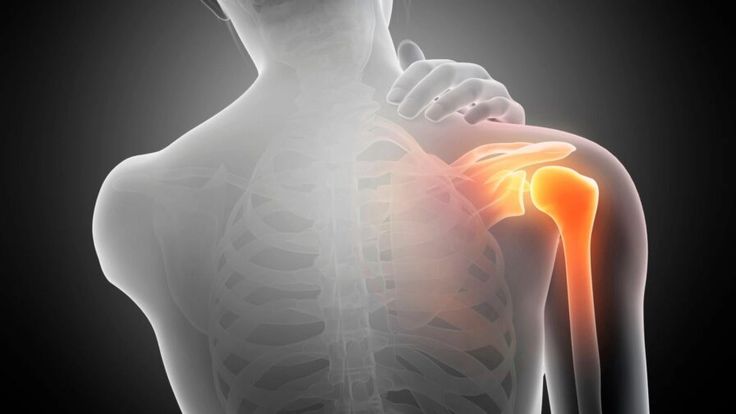 shoulder pain Treatment