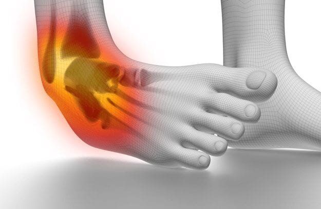 Ankle pain