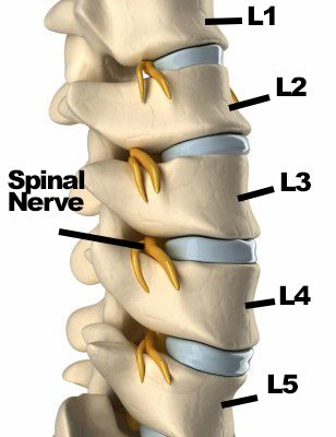 Spinal Fusion Surgery In Hyderabad