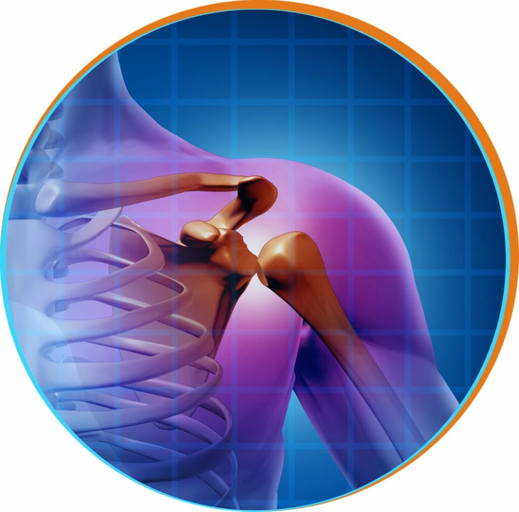 ACJ Arthritis Surgery in Hyderabad