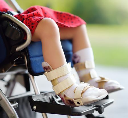 Pediatric Orthopedics in Hyderabad