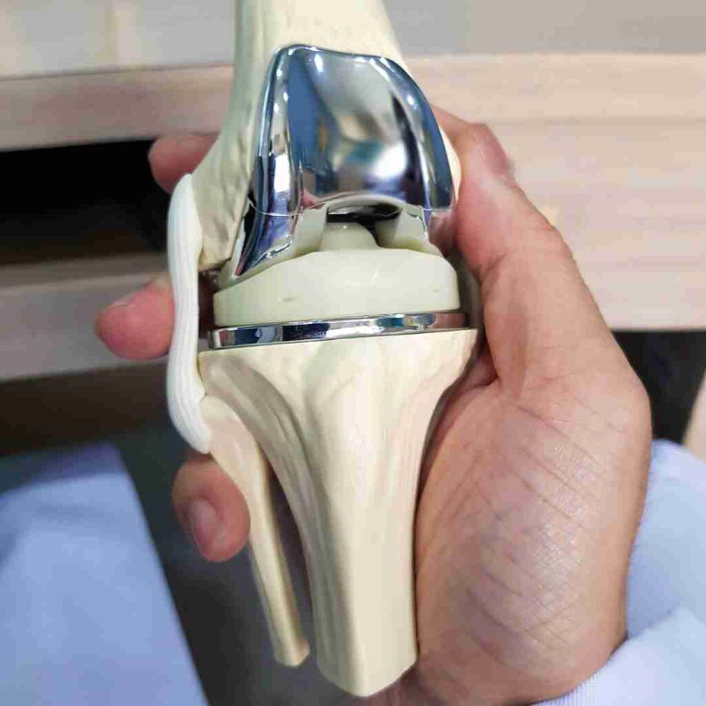 Knee Replacement Surgery in Hyderabad