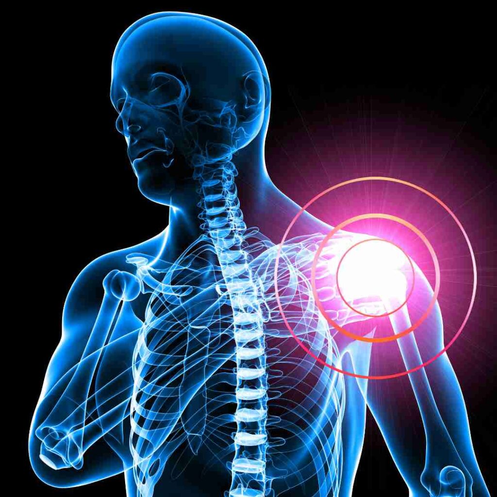 Acromioplasty Surgery in Hyderabad