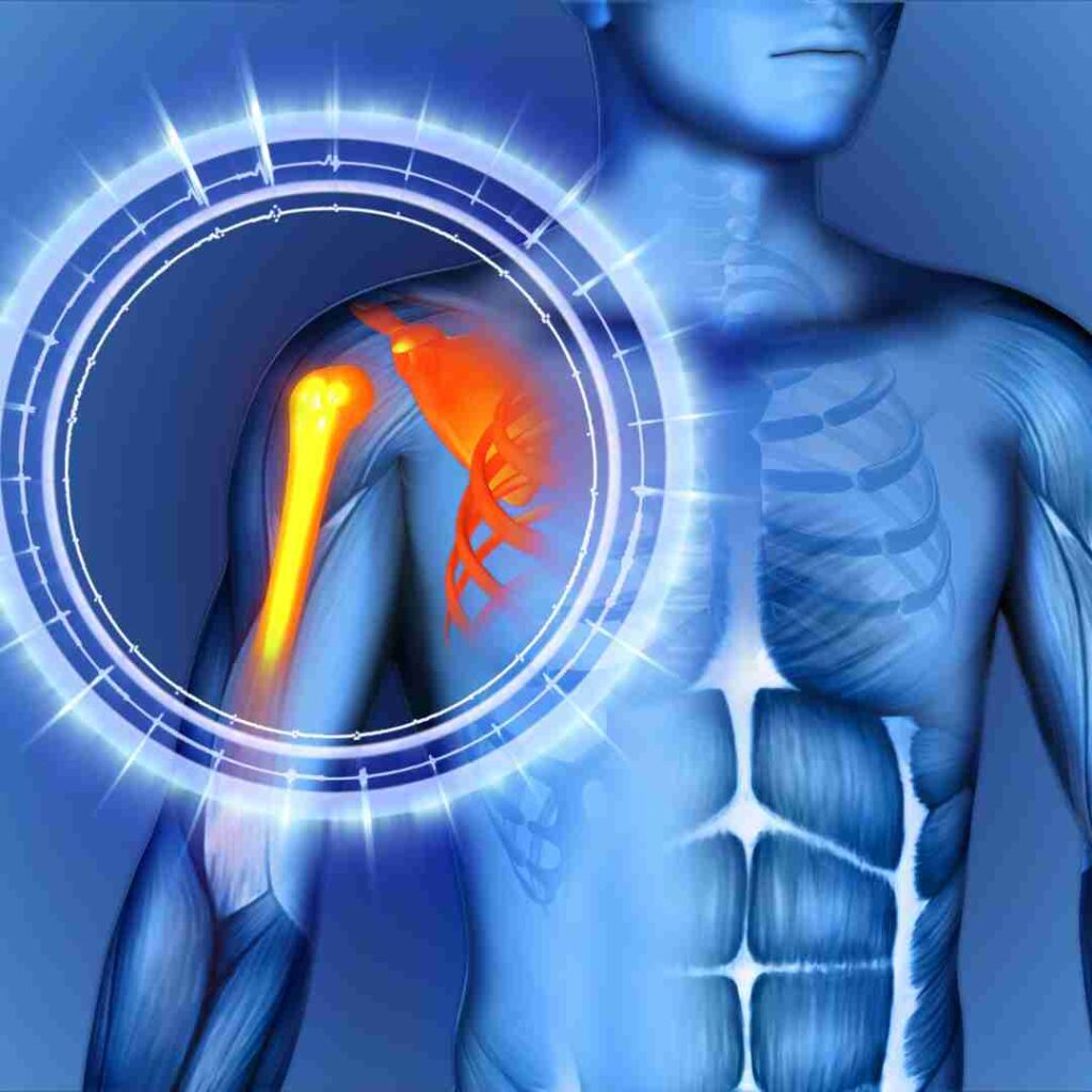 Acromioplasty Surgery in Hyderabad