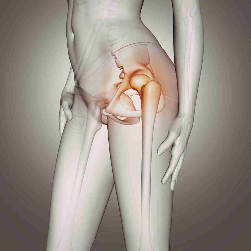 Hip Replacement Surgery in Hyderabad