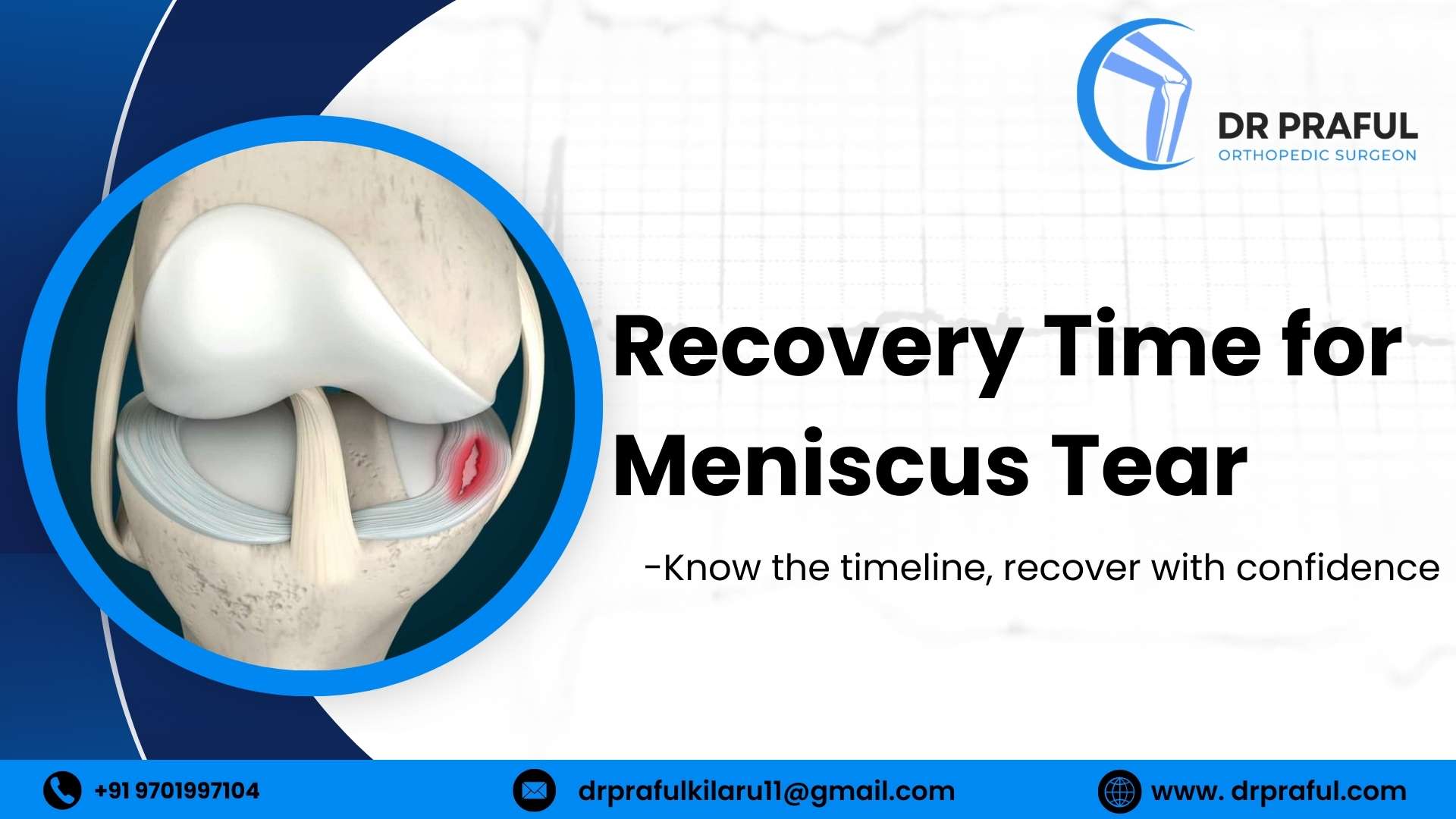 Recovery Time for Meniscus Tear