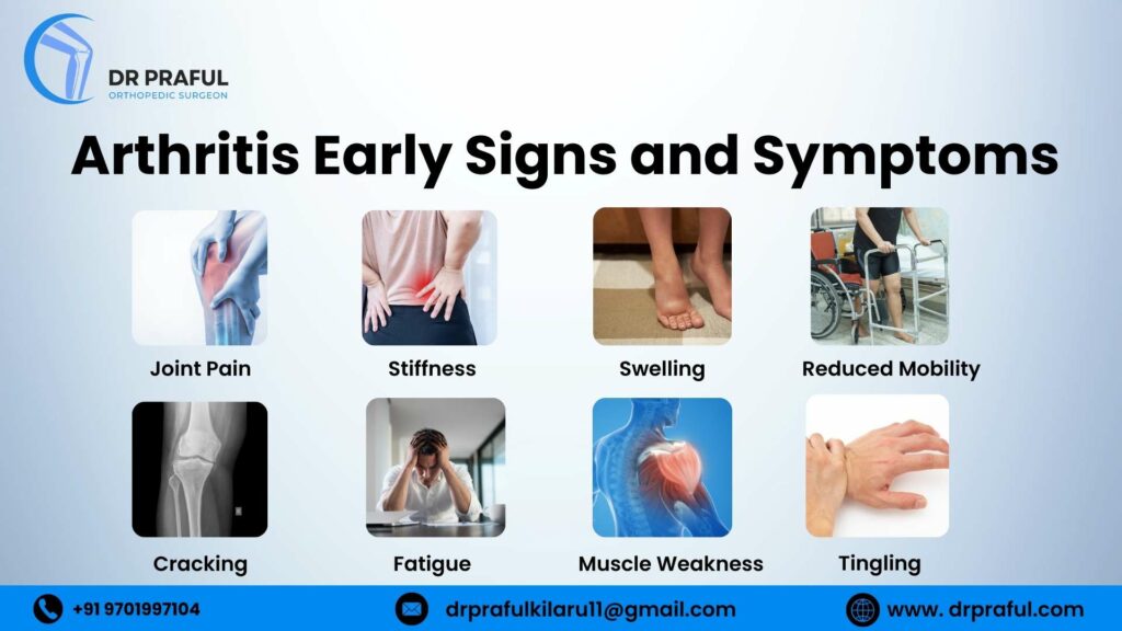 Arthritis Early Signs and Symptoms