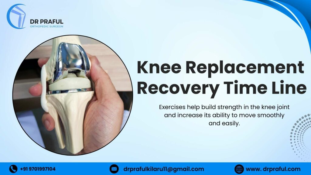 Knee Replacement Recovery Timeline