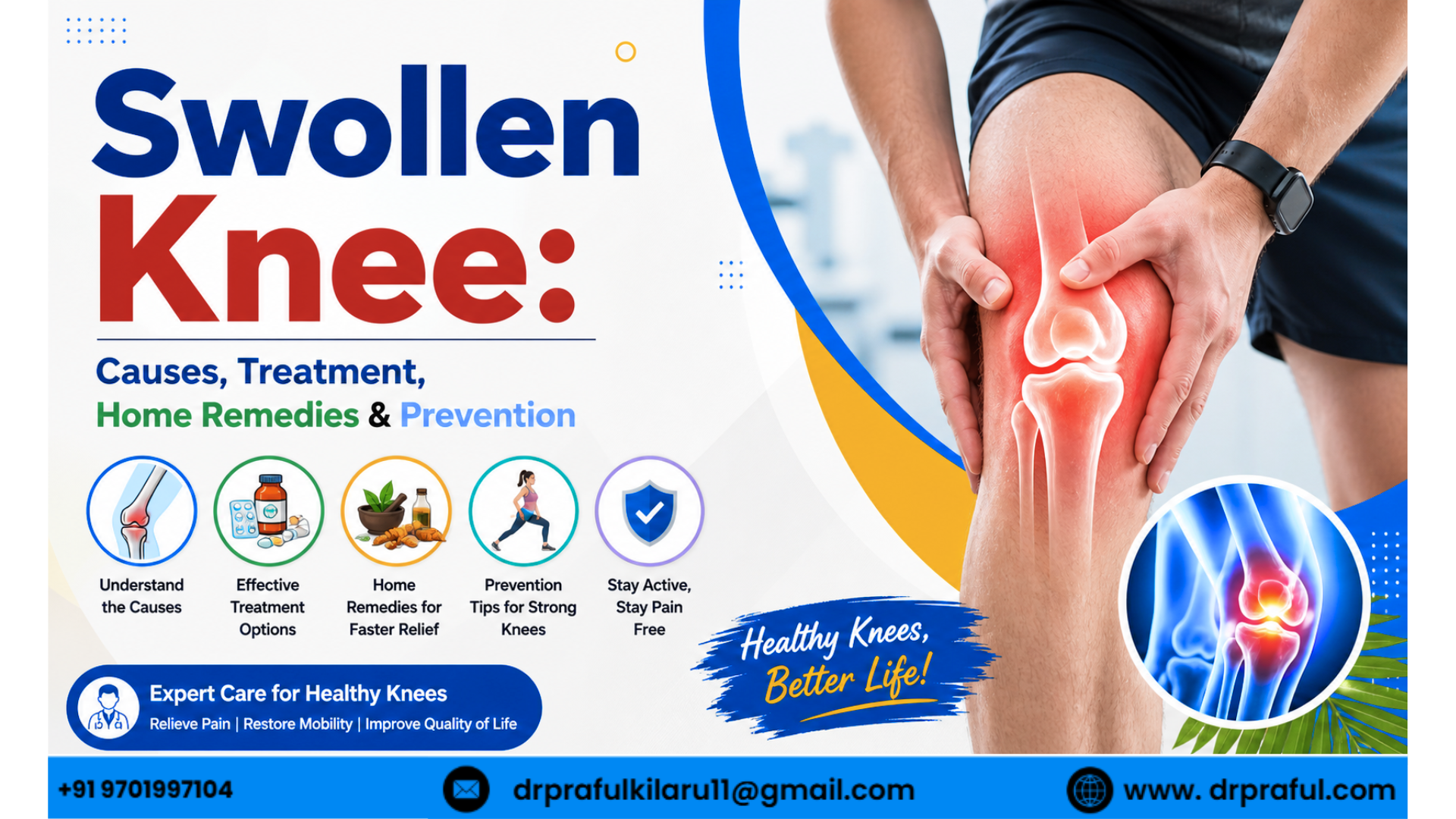 swollen kneecauses , treatment,home remedies and prevention- praful